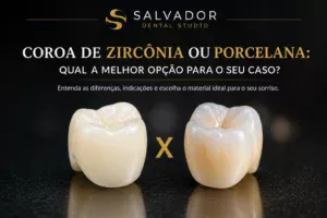 Coroa de zircônia ou porcelana: comparação entre os dois materiais
